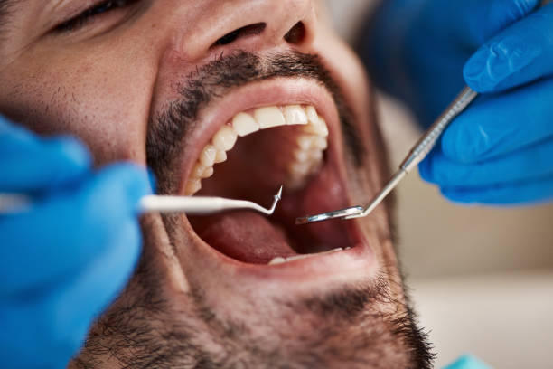 Best Urgent Dental Care for Toothache in Romulus, MI